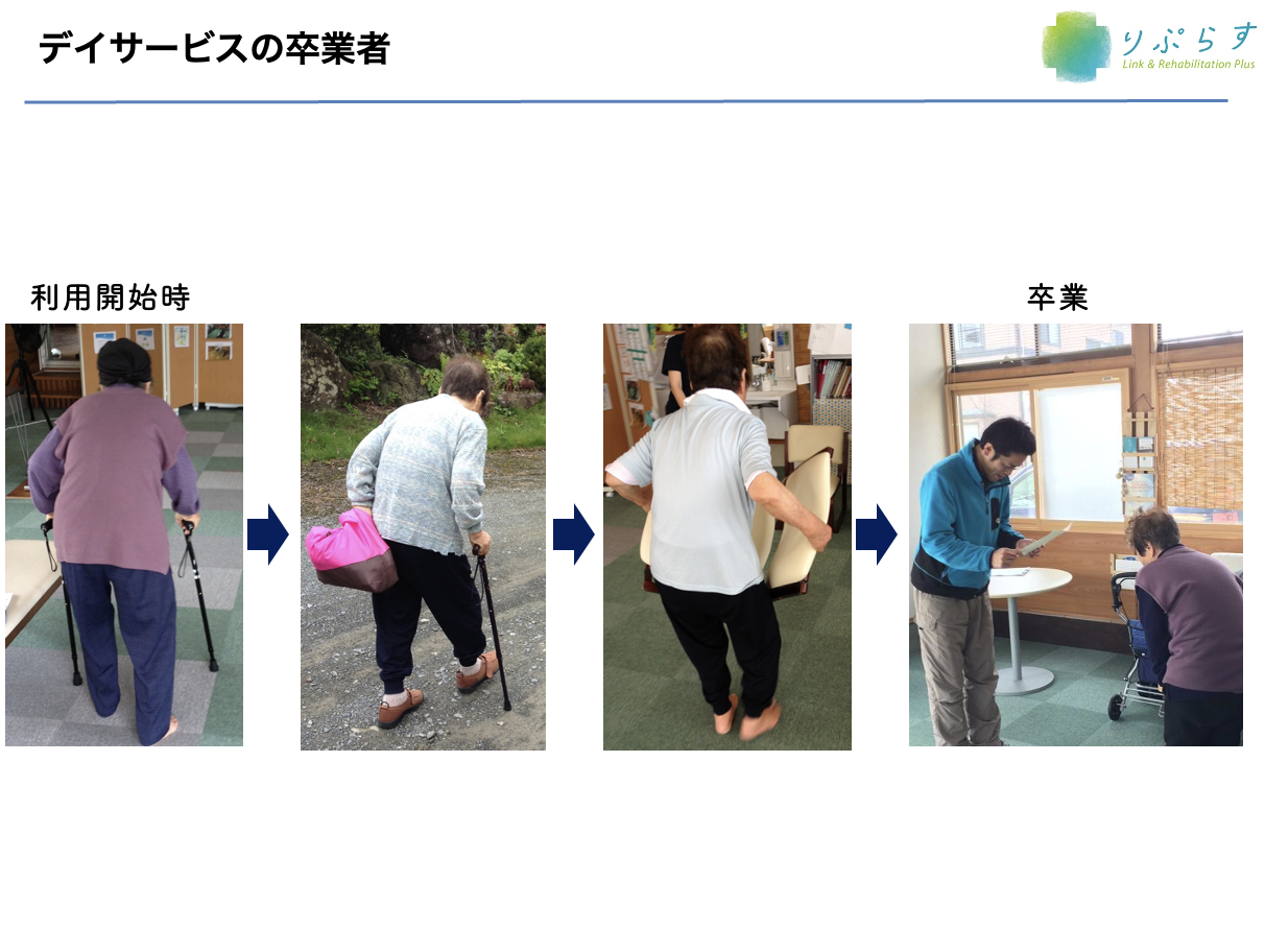 リハビリ経過：Before & After